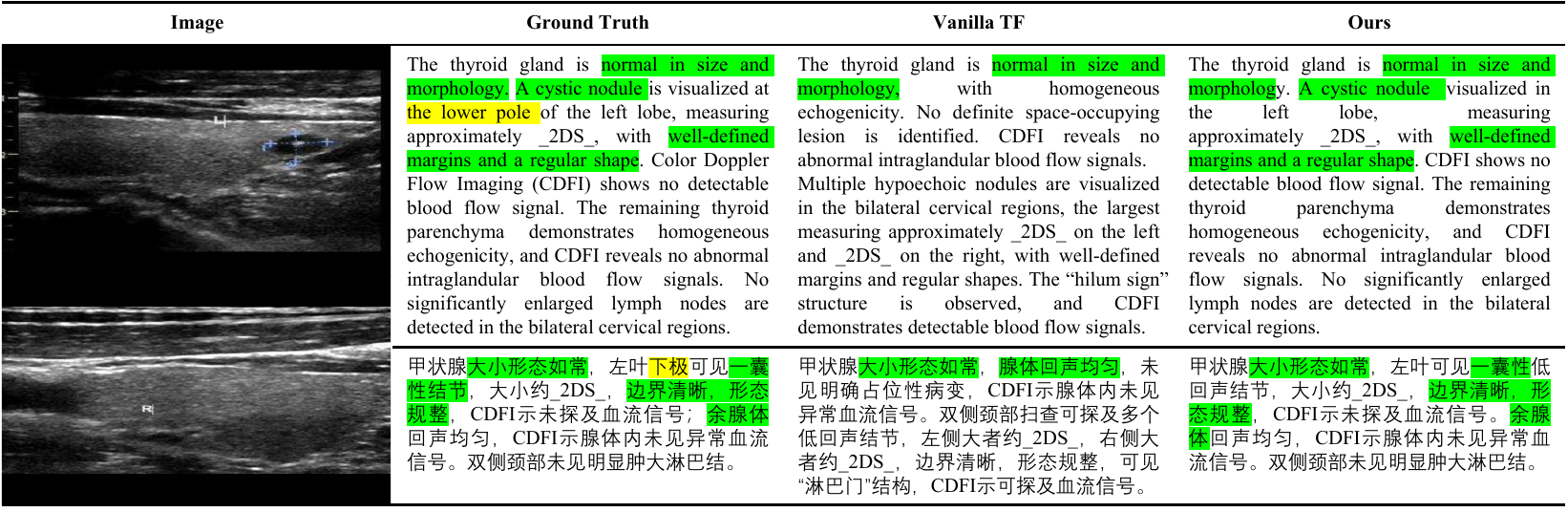 Example of a generated ultrasound report