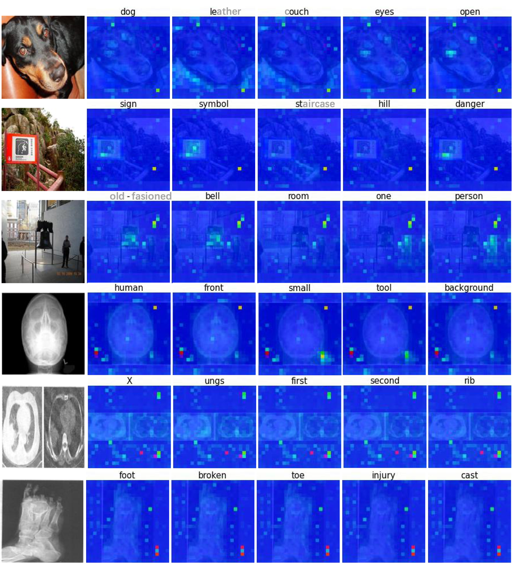 Attention visualization for medical and natural images